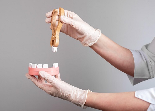 tooth-removal-cost 